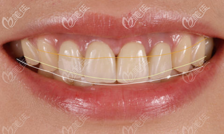 茅来发注重微笑设计理念