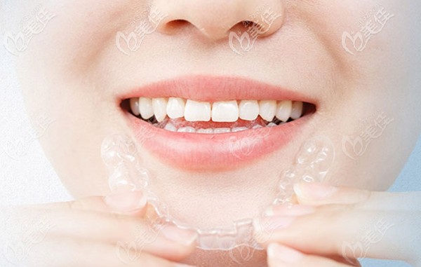 厦门峰煜口腔隐适美牙齿矫正器 厦门峰煜口腔隐适美牙齿矫正器