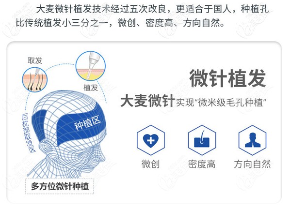 <!--<i data=20240703-sp></i>-->微针植发技术优势