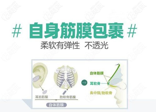 自体筋膜隆鼻原理