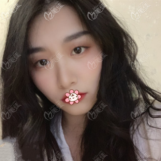 我原来的眼睛 我原来的眼睛