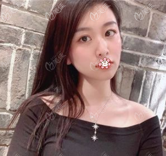 两个月后 两个月后