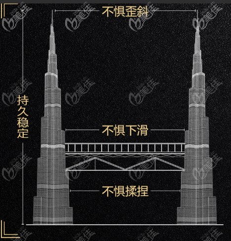 双子塔连体结构图 双子塔连体结构图