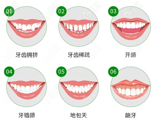 福州牙齿矫正哪里便宜？来福州博美口腔时代天使隐形牙套22880元起就能做