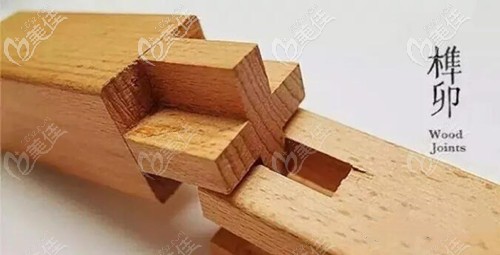 <!--<i data=20240703-sp></li>
<li><i data=20240703-sp></i>-->四维榫卯综合鼻