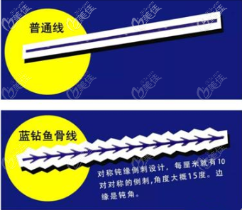 对称钝缘倒刺设计 对称钝缘倒刺设计