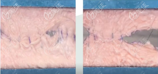 抓持组织能力强 抓持组织能力强