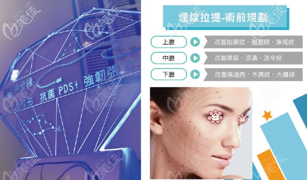 蓝钻鱼骨线的优势 蓝钻鱼骨线的优势