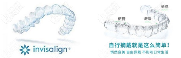 美年美华桥西口腔采用的隐适美隐形牙套