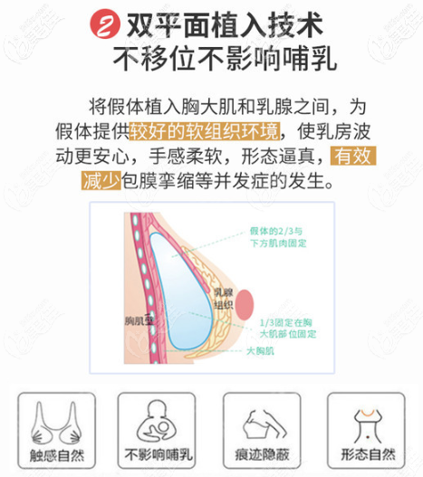 曲梅医生做胸部整形的优势 曲梅医生做胸部整形的优势