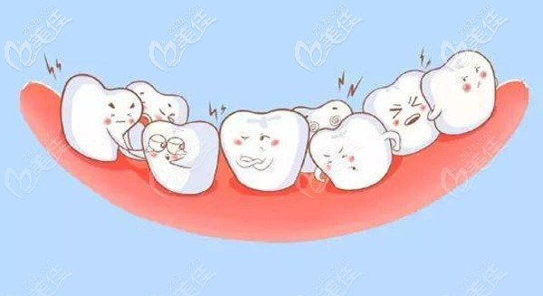 牙齿矫正是上下牙都要带吗