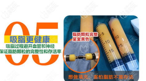 刘昆鹏医生做吸脂的优势 刘昆鹏医生做吸脂的优势