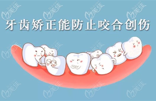 牙齿矫正还能防止咬合创伤