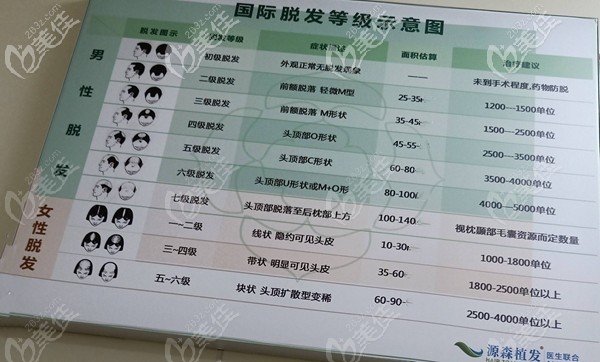 男士脱发面积等级图 男士脱发面积等级图