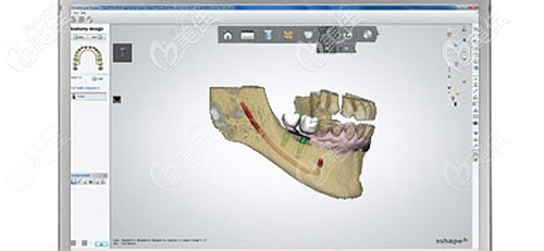 福州贝臣AD / CAM方案设计