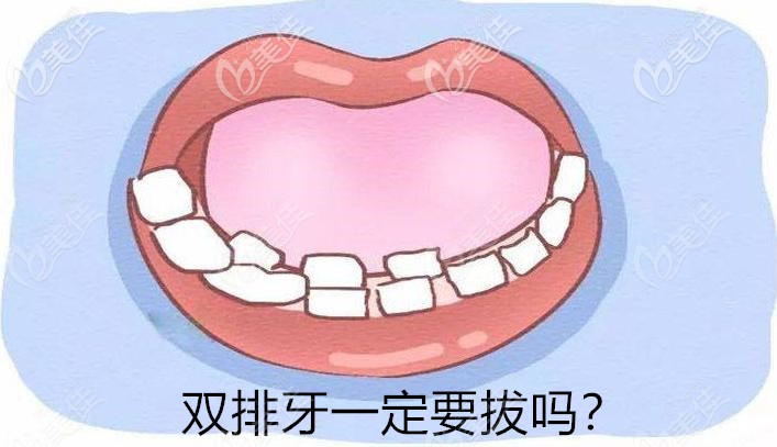 儿童双排牙一定要拔吗乳牙滞留医生不建议拔又是什么鬼