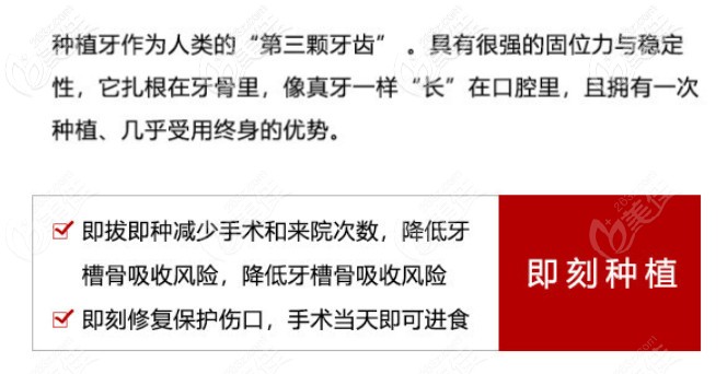 即刻种植技术