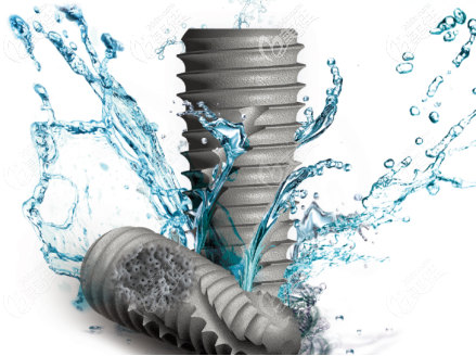 伊诺种植体形态 伊诺种植体形态