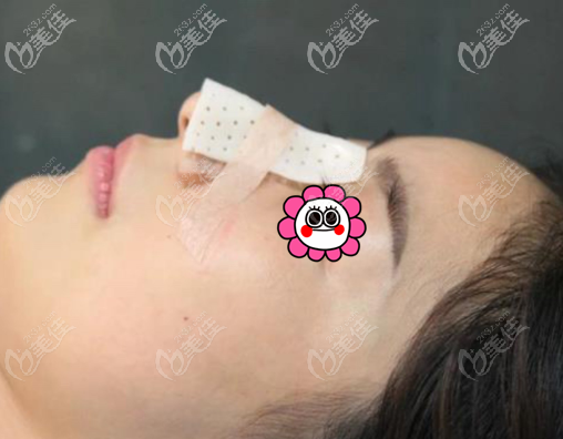 术后当天 术后当天