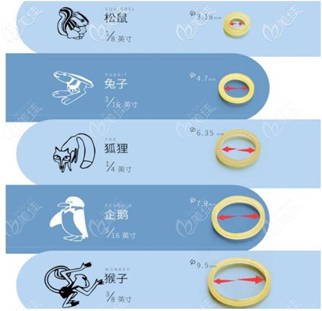 牙齿正畸矫正图案 牙齿正畸矫正图案