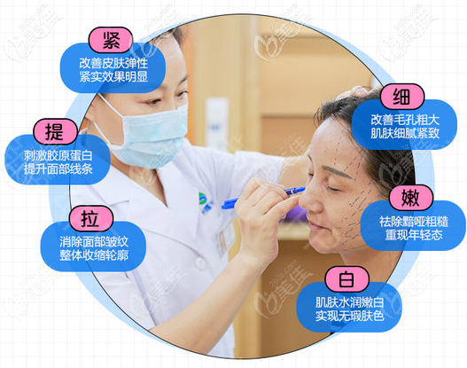 5d面雕一般收费多少钱？据说5d埋线提升维持时间和年龄有关