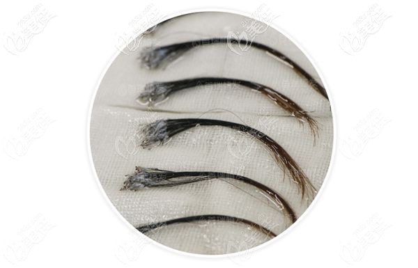 成都首瑞不剃发长发种植 成都首瑞不剃发长发种植