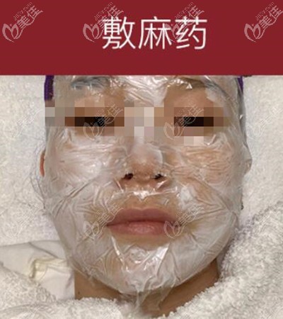 皮秒祛斑敷麻药中 皮秒祛斑敷麻药中