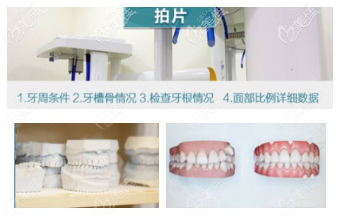 牙齿矫正整个流程