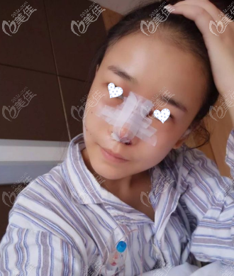 做完手术后第二天 做完手术后第二天