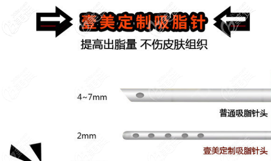 烟台壹美天成吸脂优势