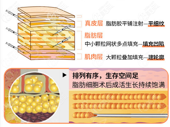 深圳南雅整形<!--<i data=20240703-sp></i>-->杰医生吸脂优势 深圳南雅整形<!--<i data=20240703-sp></i>-->杰医生吸脂优势