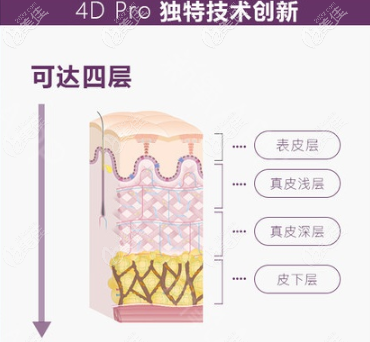 Fotona4Dpro在技术上的优势 Fotona4Dpro在技术上的优势