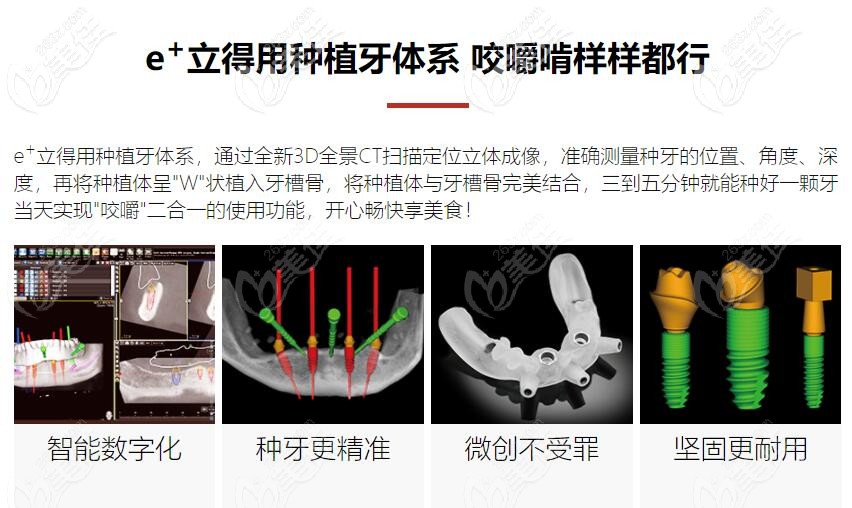 中诺自己研发的特色技术——立得用种植牙 中诺自己研发的特色技术——立得用种植牙