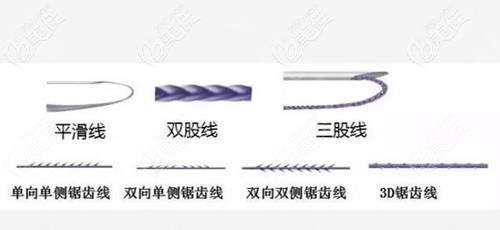 不同类型的锯齿线