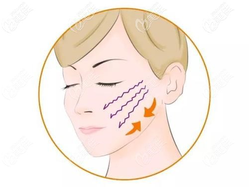 紧绷感不是因为脸肿