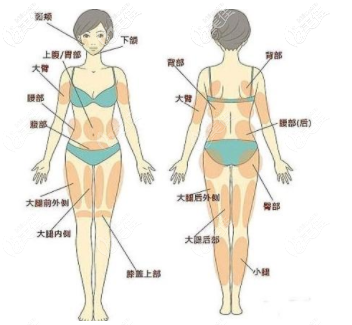 抽脂部位图