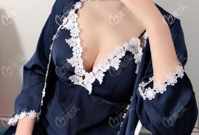 我做AD动感脂肪丰胸后乳房有波动感,做ad动感隆胸价格才5万多