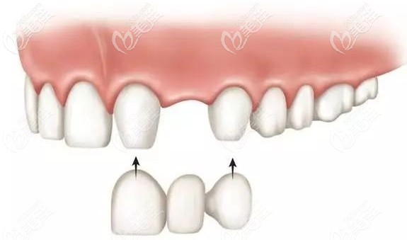 齐佳妮医生擅长多种镶牙技术 齐佳妮医生擅长多种镶牙技术
