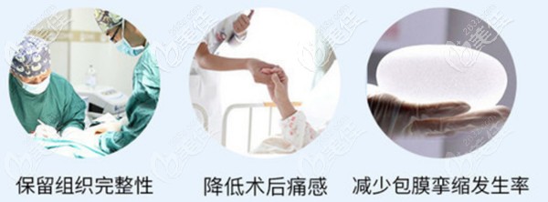 医生做假体隆胸优势
