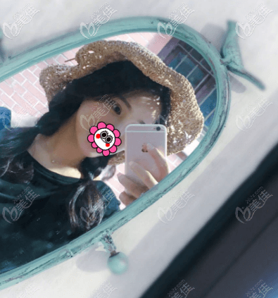 我做全切双眼皮没有出现越来越窄的情况 我做全切双眼皮没有出现越来越窄的情况