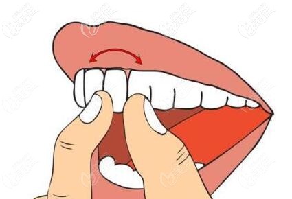 牙齿松动可以做正畸矫正吗