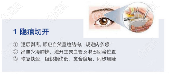 耿向阳医生做双眼皮手术的优势