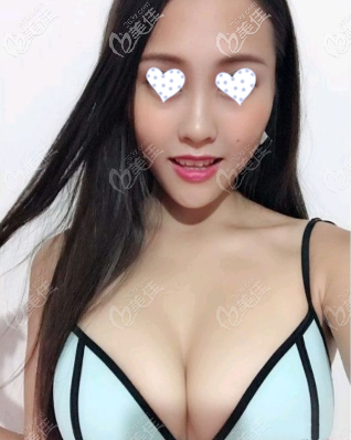 傲诺拉璀璨250cc290cc效果图 傲诺拉璀璨250cc290cc效果图