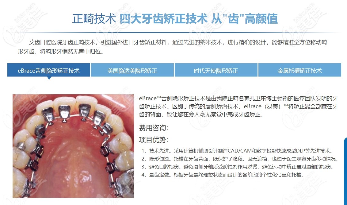 艾齿口腔四大正畸技术 艾齿口腔四大正畸技术