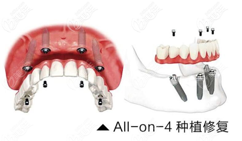 20210121_1611221988305324.jpg 20210121_1611221988305324.jpg