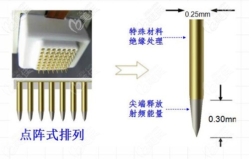 黄金微针的治疗原理