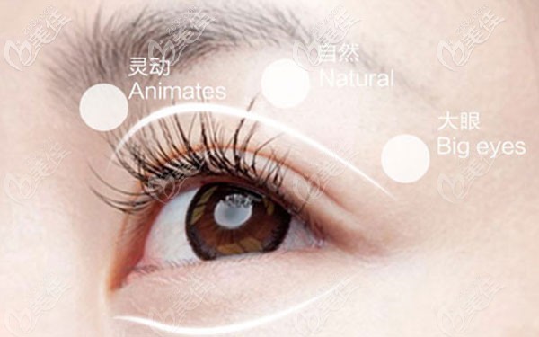 玉林华美哪个医生做双眼皮好