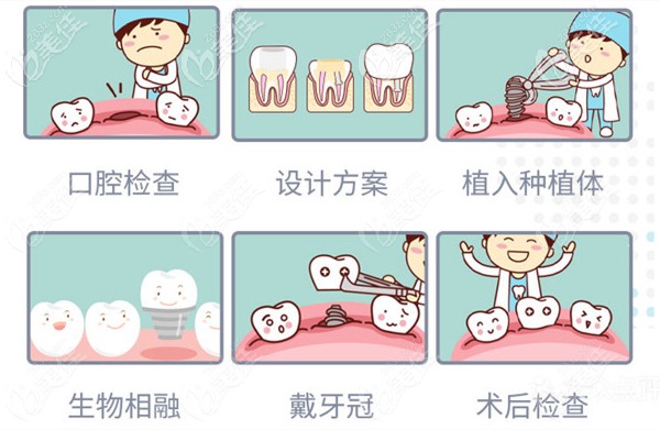 广州马泷齿科的种植牙流程