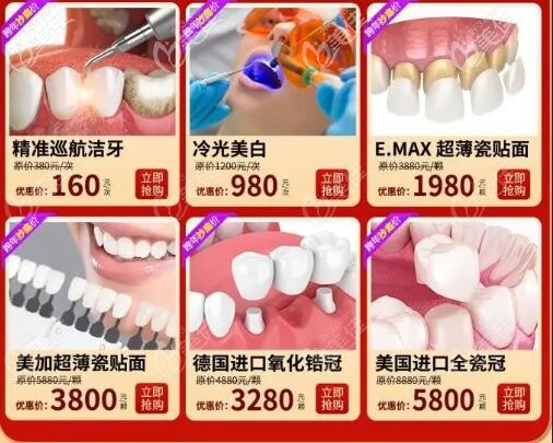 广州海珠和越秀区牙科新年送福利,emax铸瓷和美加超薄瓷贴面价格降了近一半活动海报五