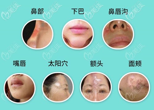 奥美定常见部位